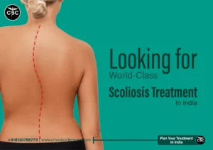Scoliosis Surgery in India