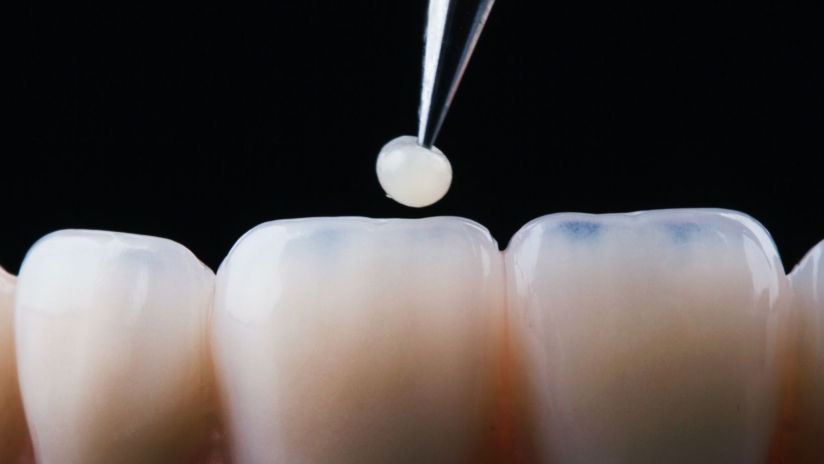 Restorative Dentistry