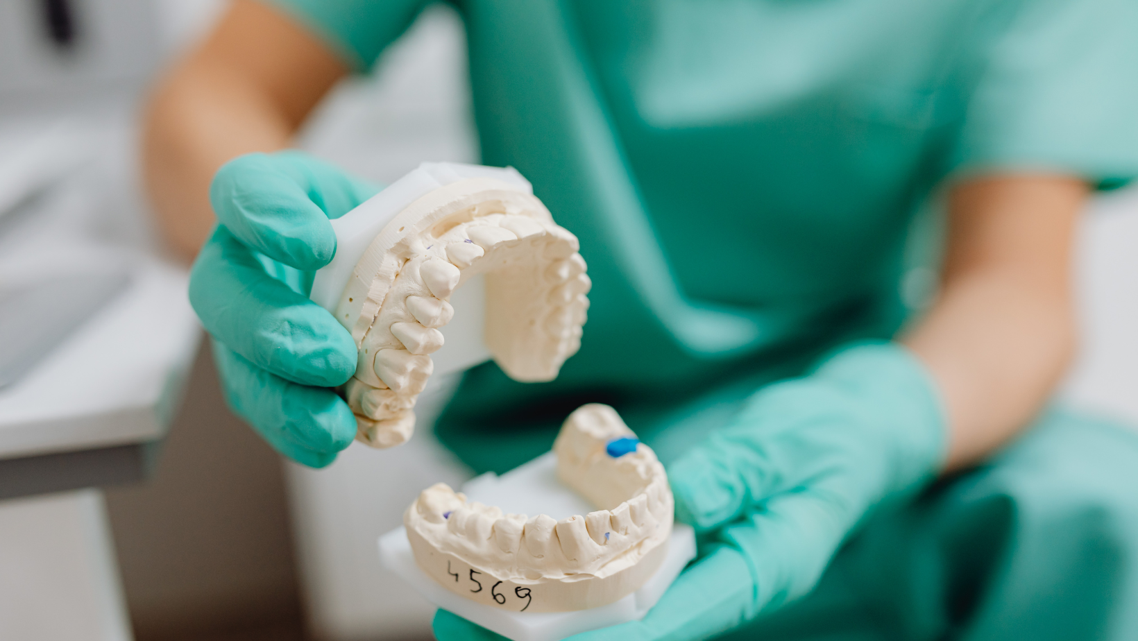 Benefits of Dental Bridges