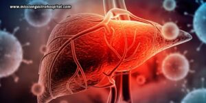 liver specialist in Ahmedabad 