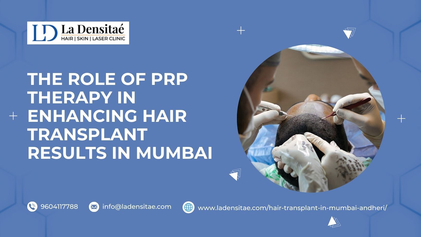 hair transplant in mumbai