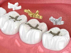 Image Source -Directory dental Liverpool